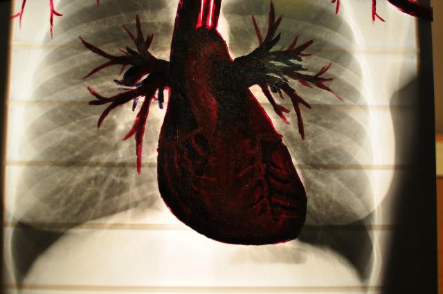 Heart, Self portrait, Allison Zielinski