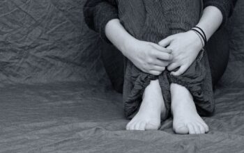 A white person's legs with their arms wrapped around them. You cannot see the head.